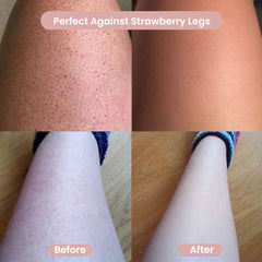 Comparison of legs labeled 'Before' and 'After' with text 'Perfect Against Strawberry Legs'.