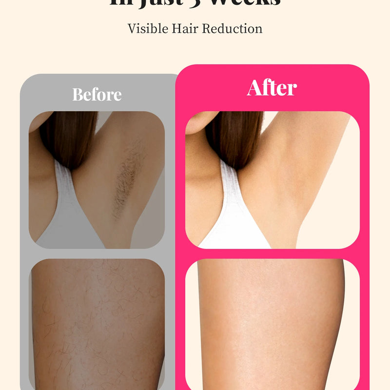 990000 Flashes Laser Hair Removal for Women and Men IPL Hair Removal Body Bikini and Facial Areas Painless Permanent HairRemoval