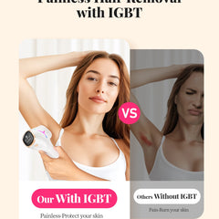 Kyvone Hair Removal Device – 990,000 Flashes For Women & Men
