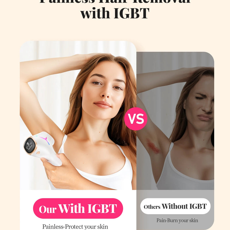 Kyvone Hair Removal Device – 990,000 Flashes For Women & Men