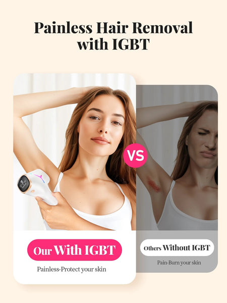 Kyvone Hair Removal Device – 990,000 Flashes For Women & Men